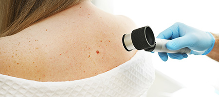 Cutaneous Oncology Timeline Image